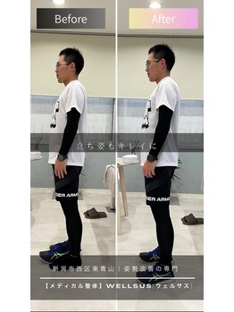ウェルサス(WELLSUS)/インソールで姿勢も綺麗に！