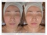 【本格毛穴ケア】血管ケア×美骨調整!欲張りプレミアムコース