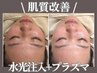小顔×肌質改善１★ノンニードル水光注入+プラズマシャワーエクソソーム¥9800