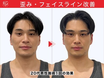 顔ジム 麻布十番店/20代男性　男の小顔矯正！