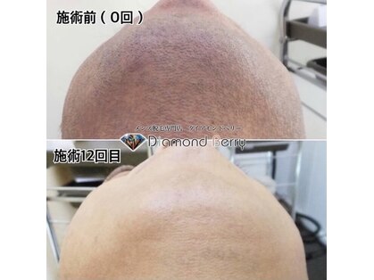 ダイアモンドベリーの写真