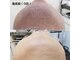 ダイアモンドベリーの写真