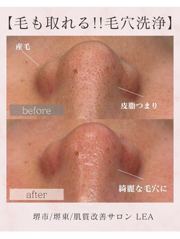 レア(Lea)/自分へのご褒美に♪