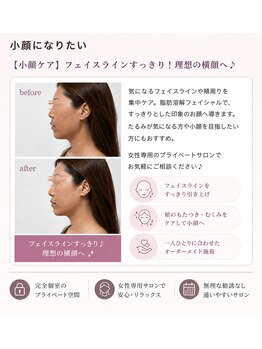 ミージュ(Miiju.)の写真/【小顔ケア】脂肪を分解×引き締め！理想のフェイスラインに♪