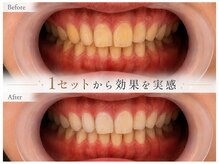 スールボーテ(soeur beaute)