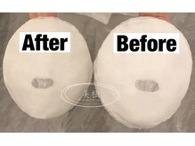 美極 トータルビューティー(美極 TOTAL BEAUTY)/恵比寿/小顔コルギ/エステ/