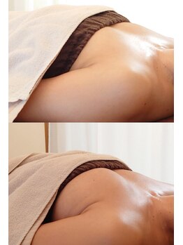 ルフルリール(Refleurir)/ずっと小胸と姿勢にお悩みでした