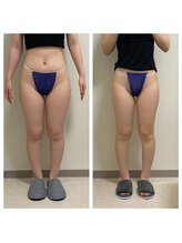 ハピネスビューティーサロン(happiness beauty salon)/