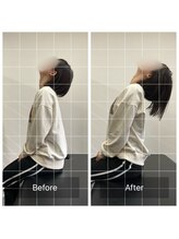 ナオル整体 大塚院(NAORU整体)/20代女性施術事例【猫背矯正】