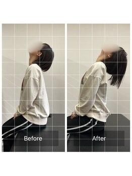 ナオル整体 大塚院(NAORU整体)/20代女性施術事例【猫背矯正】