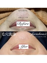 ファミーユ 太田(Fameu)/毛穴洗浄＆facialwax
