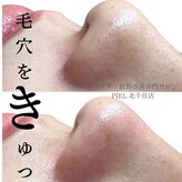 ピエル 北千住店(PIEL)