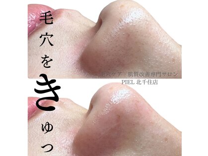 ピエル 北千住店(PIEL)の写真