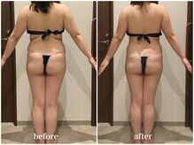 クラヴェル(Clavel)/40代前半セルゼロ2症例