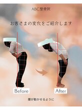 ABC整体院/腰痛整体のビフォーアフター