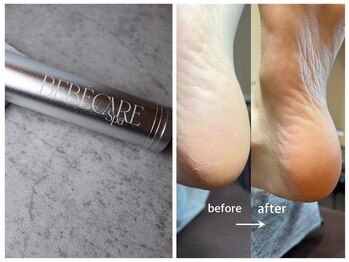 モーブ(mauve)/べべ角質ケア