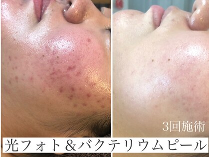 グレイティア(gratia)の写真