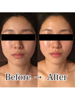 グレースフィオーレ 上野御徒町店(gracefiore)/ビフォーアフター