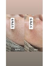 サロン ウイ(salon u'i)/～リブセラ～