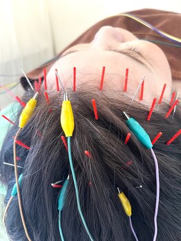 久心宝鍼灸院/キャンペーン☆~とにかく頭~