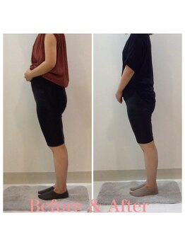 スタイルラボ高松/産後骨盤矯正の効果♪