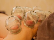 もみの木の雰囲気（本格的な、中国スタッフによる吸い玉施術が、受けられます。）