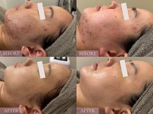 ベベ 表参道(bebe)の雰囲気(【諦めなければ必ずお肌は変わる】お肌悩みのご相談大歓迎です!)