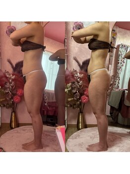 ポノ(Pono)/短期間ブライダルエステも◎!!