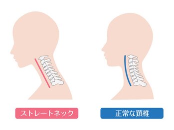 STRETCH LIVERA 北千住店/ストレッチ リヴェラ/ストレートネックとは?