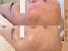 アン(An)の雰囲気(1人1人のお悩みに寄り添い根本改善に向けてしっかりサポート)