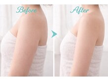 アプロ(Aphro)/見せたくなる腕へ