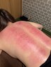 岡山稀少【身体の痛み・血流改善に】スライドカッピング+整体60分 ¥6600