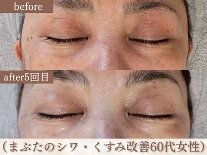 スリーエッセンス(3THREE ESSENCE)の写真