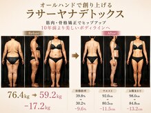 アユーラ/