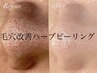 【黒ずみ・いちご鼻・毛穴つまり改善】隠さなくていい毛穴レス肌へ改善