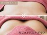 【新規】お得にキレイ♪光フォトバストUP＋全身形成トリートメント 75分
