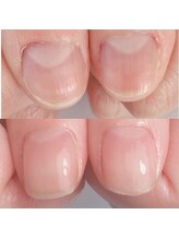 カラー(calla)/ケアコース　3ヶ月の変化
