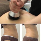 ラディア ボディ(Radia Body)