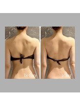 インディバ 六本木/【首肩こりケア】首肩ラインだし