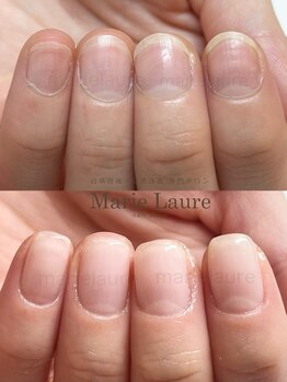 マリーロール 淀屋橋本店(Marie Laure)/自爪育成/深爪矯正/ネイルケア