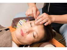 北梅田美容鍼灸院/【大阪/梅田】美容鍼灸