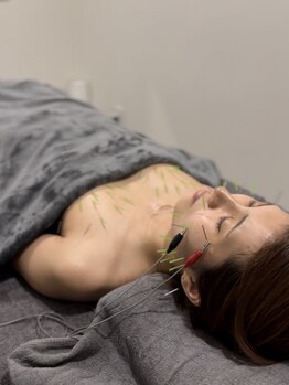 ハリスタ 六本木院(HARISTA)の写真/オープン記念バストアップ美乳鍼¥0★痩せ型さんに人気!弾力のある、ふわふわバストで嬉しい効果を実感!