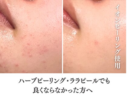 アクール(Accueil)の写真
