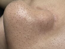 サラグランデ(Sara Grande)/お鼻チェックしてみてください！