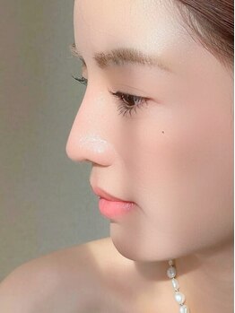 プラシア 広島駅(Purasia.)の写真/【エステ全てのコースに洗顔・クレンジング・角質ケア・仕上げマスクがセット!】男性も全メニューOK!