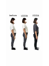 ブルーノ(Bruno)/骨格矯正ビフォーアフター