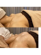 IBC 上大岡店/Before-After