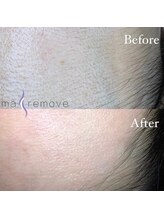 アイルームミラ 恵比寿店(mira)/マリムーブフェイシャルワックス