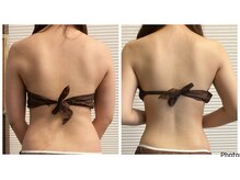 サロン ド ソワ(salon de soi)/背中のハイパーナイフ