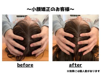 トータルビューティーみつとも/小顔矯正/インディバ/EMS